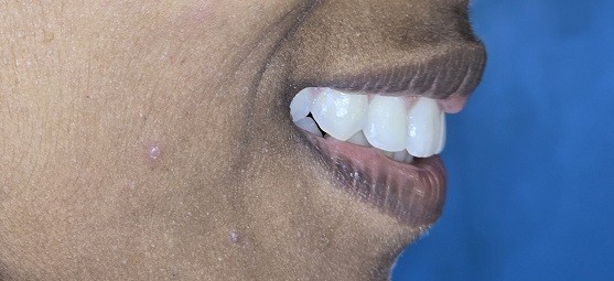 After Dental Image