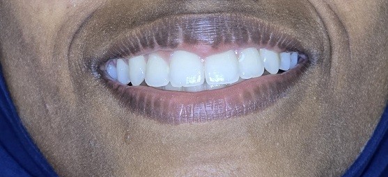 After Dental Image