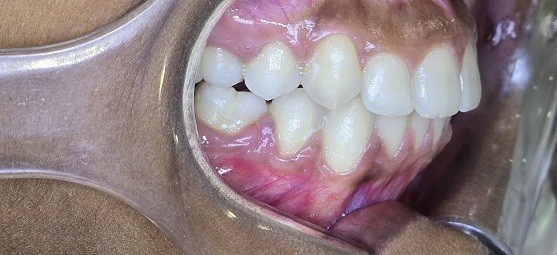 After Dental Image