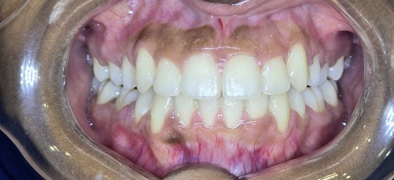After Dental Image
