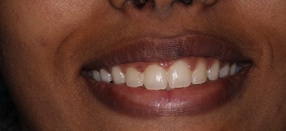 After Dental Image